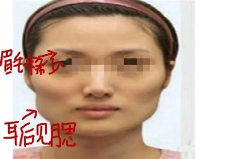 腮骨大 面相|腮骨大的女人面相 有点强势